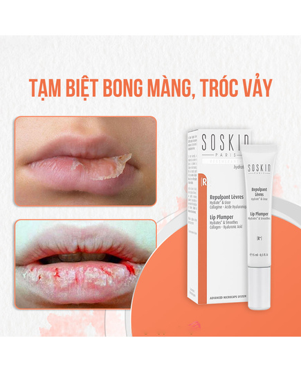 Hình Ảnh Soskin Lip Plumper - Son Dưỡng Môi Cấp Ẩm, 3 hình ảnh - sieuthilamdep.com Hình Ảnh Soskin Lip Plumper - Son Dưỡng Môi Cấp Ẩm, 3 hình ảnh - sieuthilamdep.com