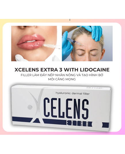 Hình Ảnh Xcelens Extra 3 Hyaluronic Dermal Filler - Filler Làm Đầy Nếp Nhăn Nông, Tăng Thể Tích Môi, 2 hình ảnh - sieuthilamdep.com Hình Ảnh Xcelens Extra 3 Hyaluronic Dermal Filler - Filler Làm Đầy Nếp Nhăn Nông, Tăng Thể Tích Môi, 2 hình ảnh - sieuthilamdep.com
