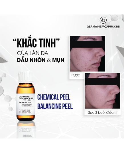 Hình Ảnh Flash Peel Germaine De Capuccini - Peel Dưỡng Sáng Đều Màu Da, 2 hình ảnh - sieuthilamdep.com Hình Ảnh Flash Peel Germaine De Capuccini - Peel Dưỡng Sáng Đều Màu Da, 2 hình ảnh - sieuthilamdep.com
