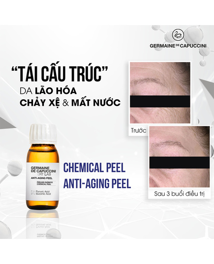 Hình Ảnh Anti-Aging Peel Germaine De Capuccini - Peel Trẻ Hoá Da, 2 hình ảnh - sieuthilamdep.com Hình Ảnh Anti-Aging Peel Germaine De Capuccini - Peel Trẻ Hoá Da, 2 hình ảnh - sieuthilamdep.com