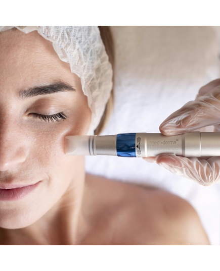 Hình Ảnh Mediderma Nanopore Pen - Bút Lăn Kim Vi Điểm, 3 hình ảnh - sieuthilamdep.com