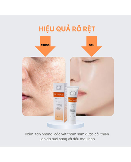Hình Ảnh LSI Tranacix Cream Skin Tone Imperfections Care Kem Giảm Thâm Nám Tàn Nhang Chuyên Sâu, 3 hình ảnh - sieuthilamdep.com